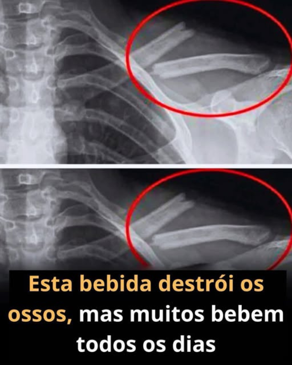 Este líquido destrói os ossos? Você sabe de qual bebida estou falando?
