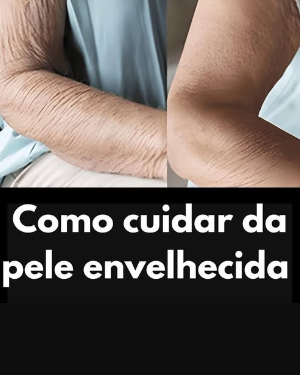 Como cuidar da pele envelhecida e manter o brilho em qualquer idade: dicas que funcionam