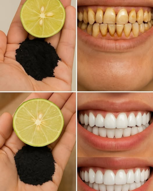 Você sabe como remover tártaro e clarear os dentes naturalmente?