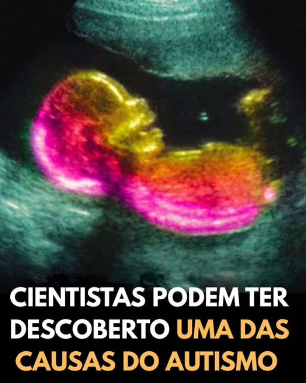 Cientistas Podem Ter Identificado Uma Peça-Chave no Autismo — O Que Isso Realmente Significa (e o Que Ainda Falta Descobrir)