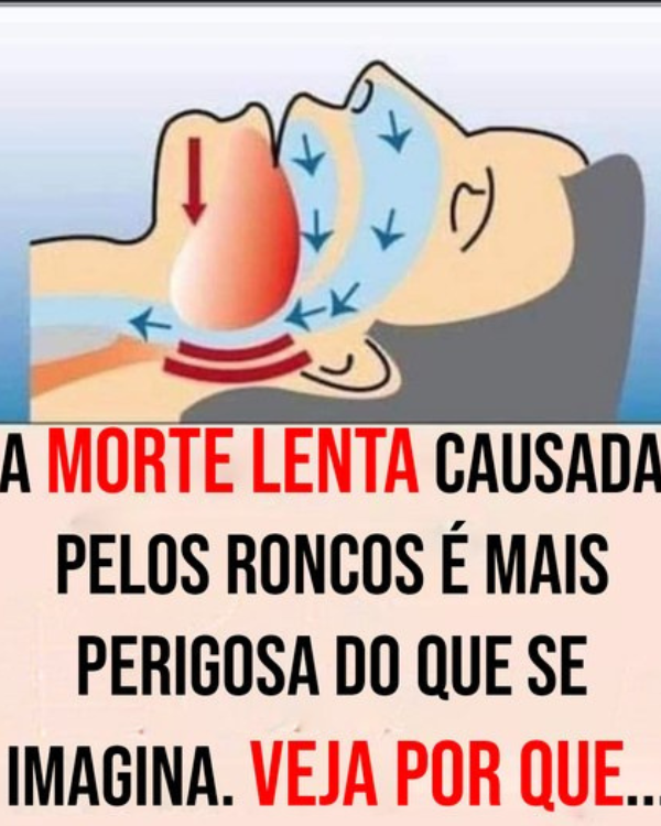 Apneia do sono: estudos alertam para os riscos do ronco e o impacto na saúde