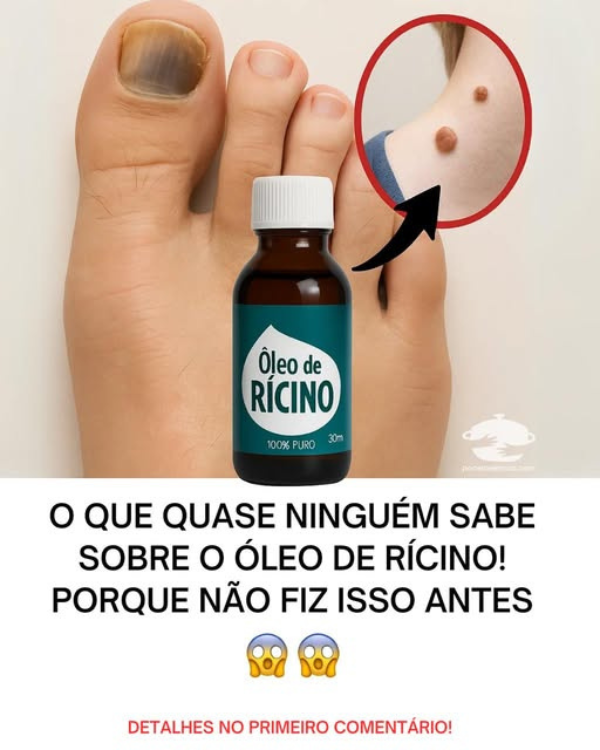 O que quase ninguém sabe sobre o óleo de rícino! Porque não fiz isso antes