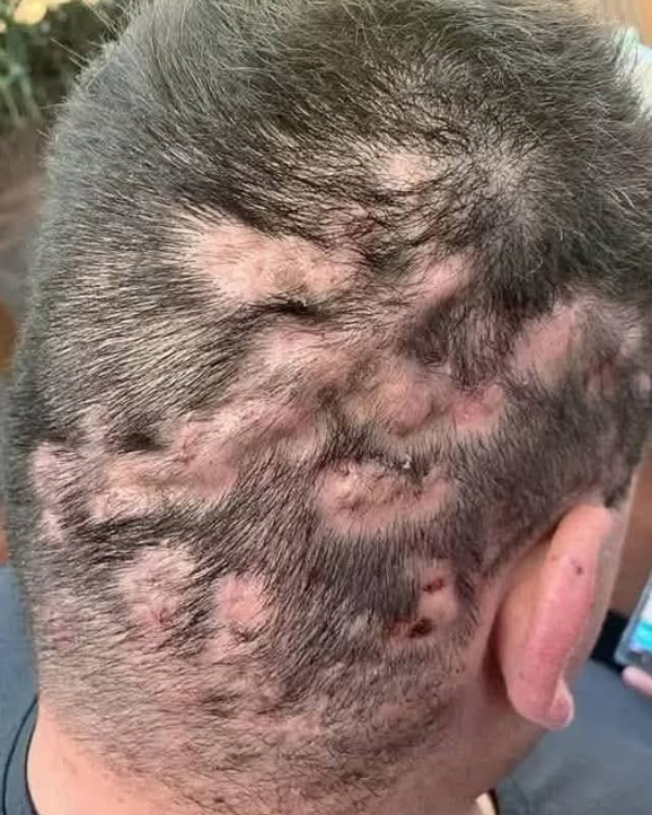 Sinais de alerta precoce: sinais de que sua saúde está em risco