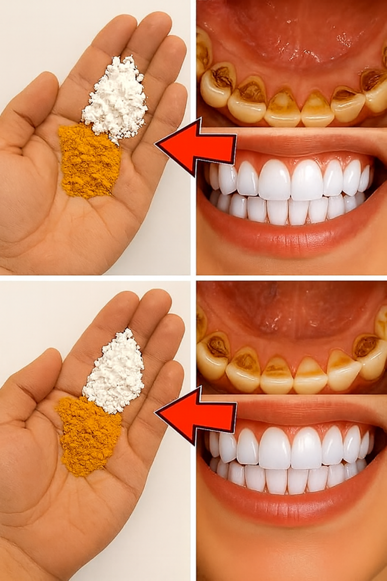 Você sabe como remover tártaro e clarear os dentes naturalmente